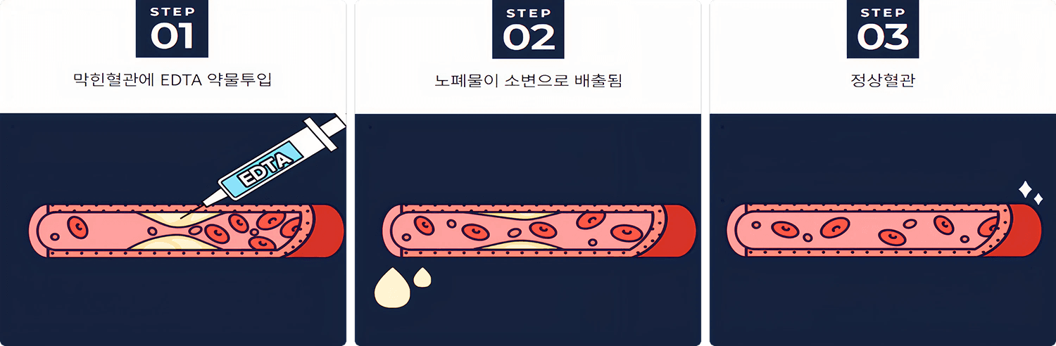 EDTA 킬레이션 주사 안내 이미지