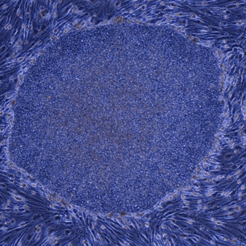 역분화줄기세포